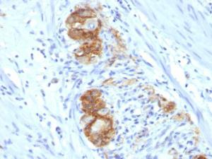 Immunohistochemical analysis of formalin-fixed, paraffin-embedded human colon ganglion using Anti-NCAM1 Antibody [123C3D5]