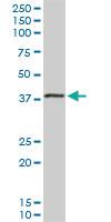 Anti-EIF2B2 Rabbit Polyclonal Antibody