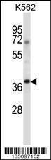 Anti-NCK1 Rabbit Polyclonal Antibody (Biotin)