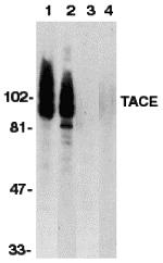 Western blot analysis of TACE in HeLa and Jurkat whole cell lysate in the absence or presence of blocking peptide (Cat. No. 1131P) with TACE antibody at 1:500 dilution.