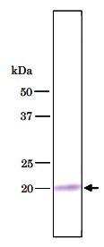 Anti-U1-C antibody