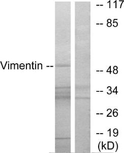 Western blot analysis of lysates from 293 cells, treated with EGF 200ng/ml 30' using Anti-Vimentin Antibody. The right hand lane represents a negative control, where the antibody is blocked by the immunising peptide.