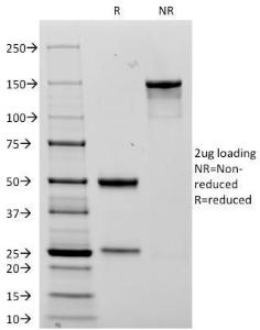 SDS-PAGE analysis of Anti-NCAM1 Antibody [123C3D5] under non-reduced and reduced conditions; showing intact IgG and intact heavy and light chains, respectively SDS-PAGE analysis confirms the integrity and purity of the antibody