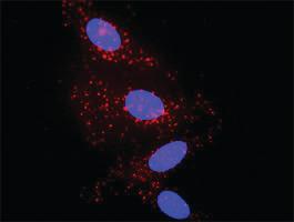 Anti-A2M Mouse Monoclonal Antibody [clone: 2B5]