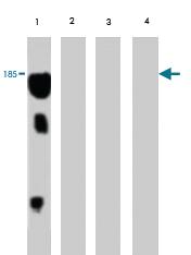 Anti-VTG Mouse Monoclonal Antibody [clone: 5A4]