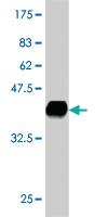 Anti-MTSS1 Mouse Monoclonal Antibody [clone: 2G9]