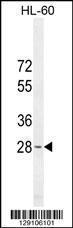 Anti-METTL10 Rabbit Polyclonal Antibody