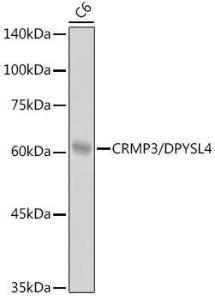 Western blot analysis of extracts of C6 cells, using Anti-CRMP3 Antibody [ARC2530] (A307756) at 1:1000 dilution. The secondary Antibody was Goat Anti-Rabbit IgG H&L Antibody (HRP) at 1:10000 dilution. Lysates/proteins were present at 25 µg per lane