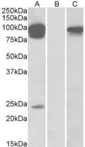 HEK293 lysate (10ug protein in RIPA buffer) overexpressing Human TRPV3 with DYKDDDDK tag probed with Anti-TRPV3 Antibody (A84562) (0.5µg/ml) in Lane A and probed with anti- DYKDDDDK Tag (1/10000) in lane C