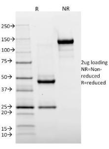 SDS-PAGE analysis of Anti-HLA DR Antibody [TAL 1B5] under non-reduced and reduced conditions; showing intact IgG and intact heavy and light chains, respectively. SDS-PAGE analysis confirms the integrity and purity of the Antibody