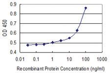 Anti-A2M Mouse Monoclonal Antibody [clone: 2B5]