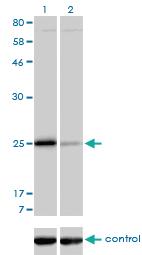 Anti-TNNI3 Mouse Monoclonal Antibody [clone: 1E7]