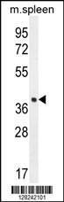 Anti-LHFPL5 Rabbit Polyclonal Antibody (APC (Allophycocyanin))