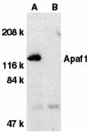 Western blot analysis of Apaf1 in human heart tissue lysate with Apaf1 antibody at 1 &#956;g/mL dilution in the absence (A) or presence (B) of blocking peptide (2015P).