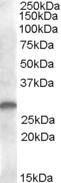 Anti-CLEC1B Antibody (A82949) (1 µg/ml) staining of human kidney lysate (35 µg protein in RIPA buffer). Primary incubation was 1 hour. Detected by chemiluminescence