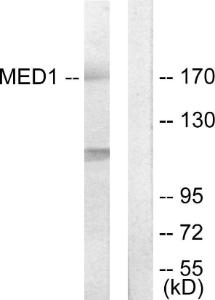 Western blot analysis of lysates from Jurkat cells using Anti-MED1 Antibody. The right hand lane represents a negative control, where the antibody is blocked by the immunising peptide