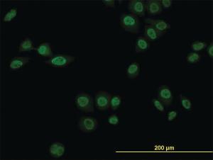 Anti-NR1D1 Mouse Monoclonal Antibody [clone: 4F6]