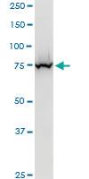 Anti-EPC1 Mouse Polyclonal Antibody