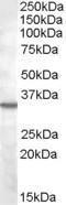 Anti-BDKRB1 Antibody (A84563) (2 µg/ml) staining of K562 lysate (35 µg protein in RIPA buffer). Primary incubation was 1 hour. Detected by chemilu minescence