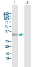 Anti-NAT1 Rabbit Polyclonal Antibody