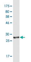 Anti-UCP1 Mouse Monoclonal Antibody [clone: 4B7]