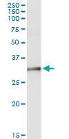 Anti-NAT1 Rabbit Polyclonal Antibody