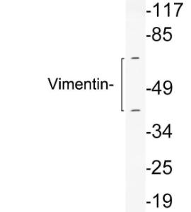 Western blot analysis of lysates from 293 cells using Anti-Vimentin Antibody