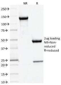 Anti-DNMT3A antibody