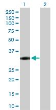 Anti-NAT1 Rabbit Polyclonal Antibody