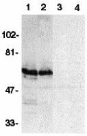 Western blot analysis of SODD in HeLa (1,3) and THP-1 (2,4) whole cell lysates in the absence (1,2) or presence (3,4) of blocking peptide (2143P) with SODD antibody at 1:500 dilution.