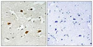 Immunohistochemical analysis of paraffin-embedded human brain using Anti-p27 Kip1 (phospho Thr157) Antibody 1:100 (4°C overnight). The right hand panel represents a negative control, where the antibody was pre-incubated with the immunising peptide.