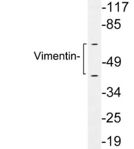 Western blot analysis of lysates from 293 cells using Anti-Vimentin Antibody