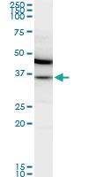 Anti-MDH2 Mouse Monoclonal Antibody [clone: 1G12]