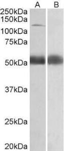 Anti-COPA Antibody (A82951) (0.5 µg/ml) staining of Human Prostate lysate (35 µg protein in RIPA buffer) with (B) and without (A) blocking with the immunizing peptide. Primary incubation was 1 hour. Detected by chemiluminescence