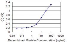 Anti-MDH2 Mouse Monoclonal Antibody [clone: 1G12]