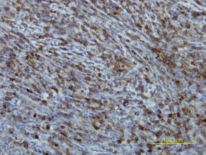 Anti-EIF2B2 Mouse Monoclonal Antibody [clone: 5B12-E10]