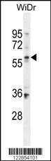 Anti-BCMO1 Rabbit Polyclonal Antibody (HRP (Horseradish Peroxidase))