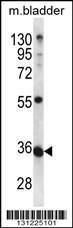 Anti-METTL11B Rabbit Polyclonal Antibody