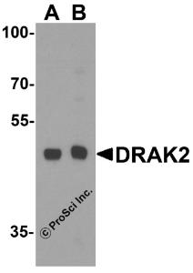 Western blot analysis of DRAK2 in Jurkat (1,3) and Raji (2,4) cell lysate in the absence (1,2) or presence (3,4) of blocking peptide (2149P) with DRAK2 antibody at 1:500 dilution.