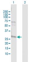 Anti-NAT2 Rabbit Polyclonal Antibody