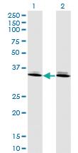 Anti-DLX6 Mouse Monoclonal Antibody [clone: 2D7]