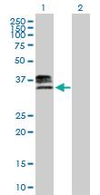 Anti-HS3ST1 Mouse Polyclonal Antibody