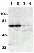 Western blot analysis of DR6 in K562 (1,3) and Raji (2,4) whole cell lysate in the absence (1,2) or presence (3,4) of blocking peptide (2157P) with DR6 antibody at 1:500 dilution.