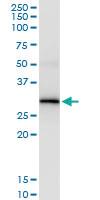 Anti-NAT2 Rabbit Polyclonal Antibody