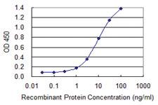 Anti-DLX6 Mouse Monoclonal Antibody [clone: 2D7]