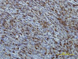 Anti-EIF2B2 Mouse Monoclonal Antibody [clone: 5B12-E10]