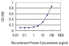 Anti-TNNI3 Mouse Monoclonal Antibody [clone: 1E7]