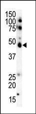 Anti-CSNK1E Rabbit Polyclonal Antibody (APC (Allophycocyanin))