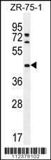 Anti-METTL2B Rabbit Polyclonal Antibody (APC (Allophycocyanin))