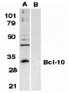 Western blot analysis of Bcl-10 in Raji whole cell lysate in the absence (A) or presence (B) of peptide (2161P) with Bcl-10 antibody at 1:500 dilution.